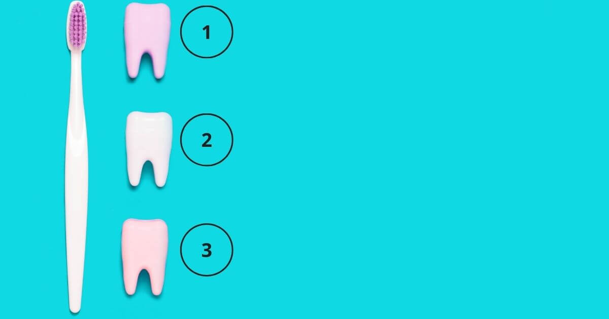 3 שיניים שמראות את השלבים של טיפול שורש