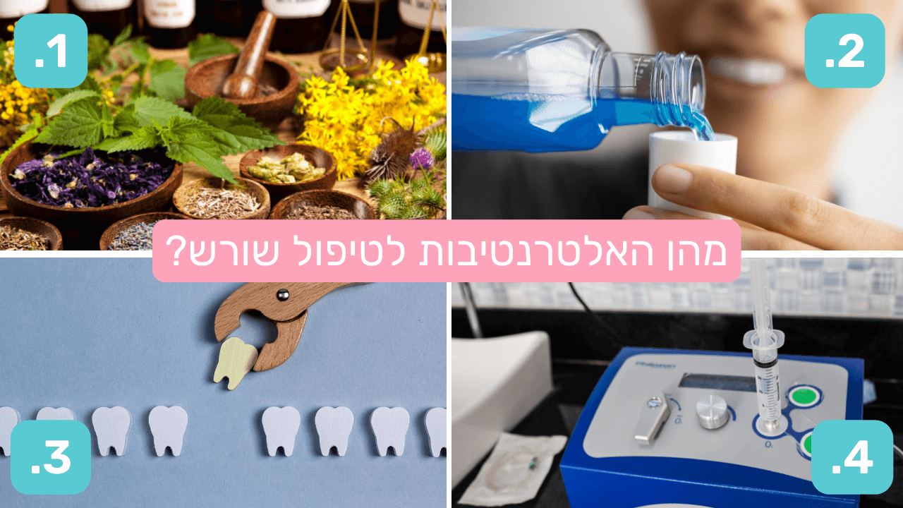 Read more about the article מהן האלטרנטיבות לטיפול שורש?