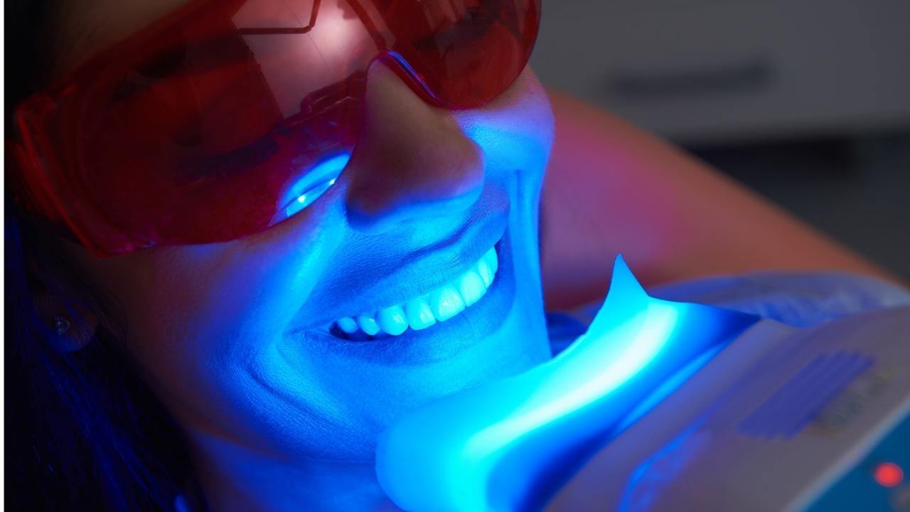 קליניקה להלבנת שן שעברה טיפול שורש